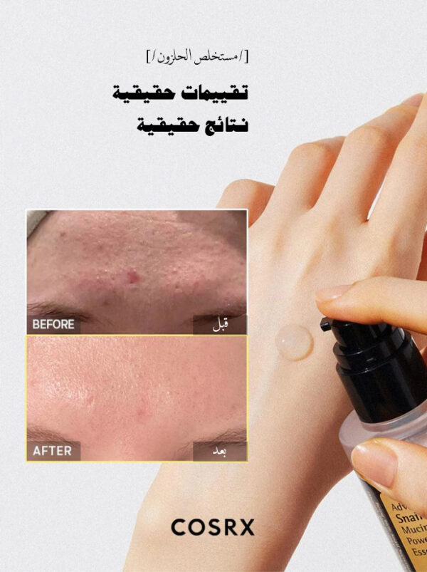 Ninala Skin Care Advanced Snail 96 Mucin Power Essence | Iraq